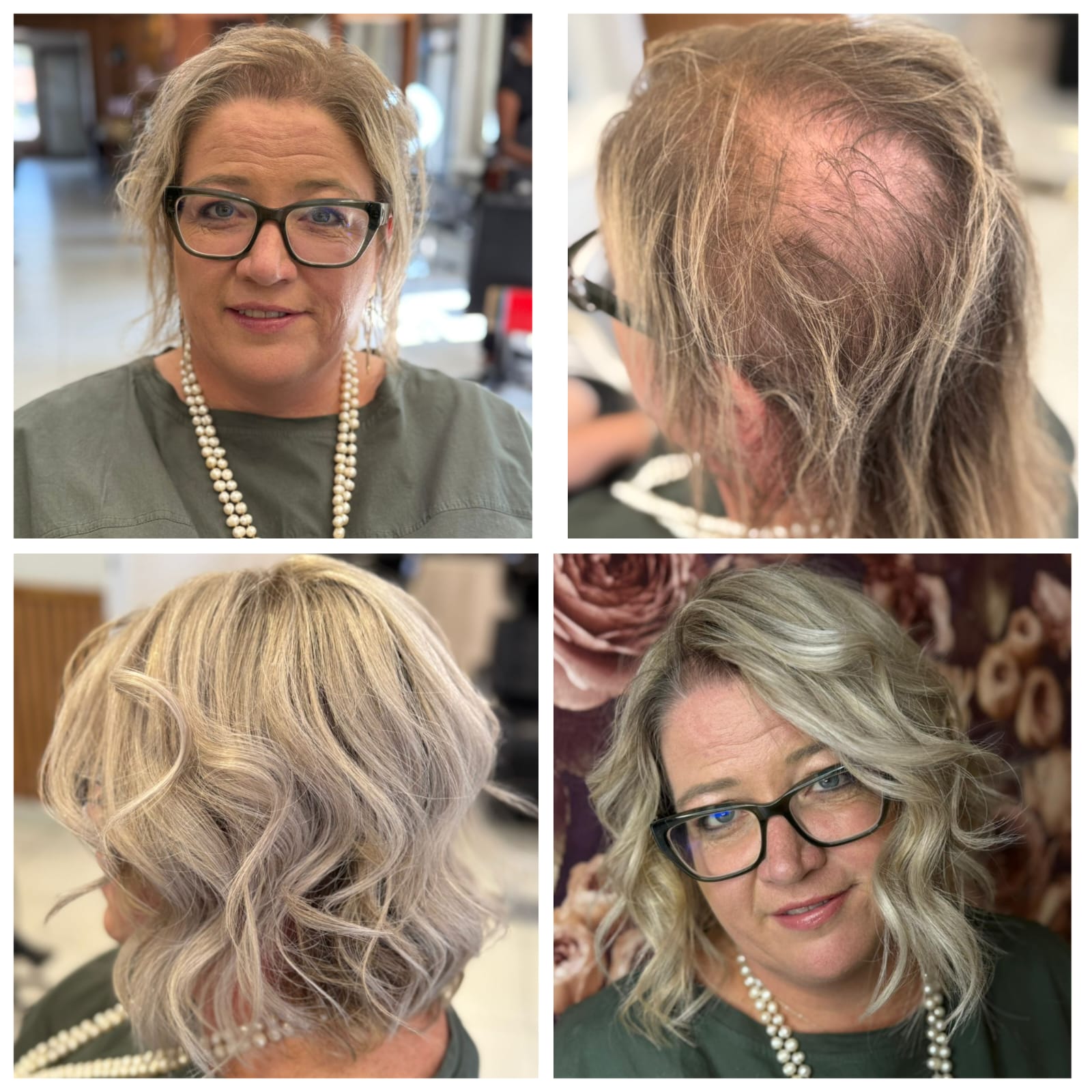 Before & After 5